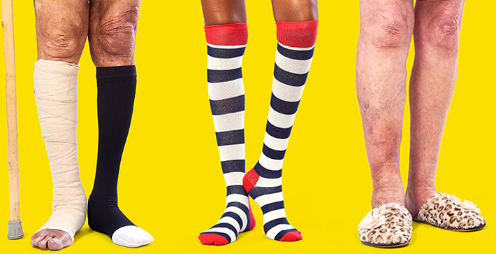 Three different legs for the Legs Matter Campaign