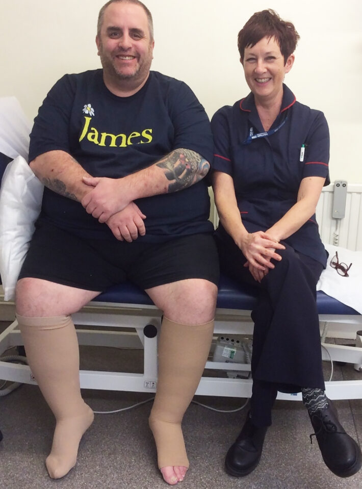 Carl and Sarah Gardner, Clinical Lead Tissue Viability Service in Oxford Health NHS FT - Legs Matter Week campaign 2019