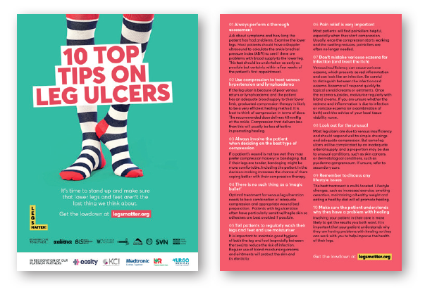 A5 10 Top Tips flyer – provides tips on how to look after your legs and feet