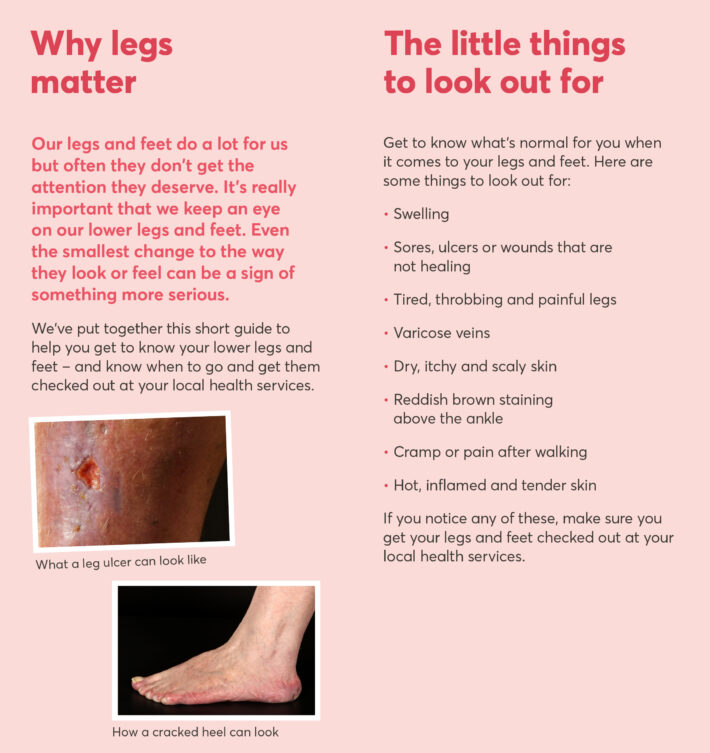 Spread from Legs Matter knees to toes patient leaflet