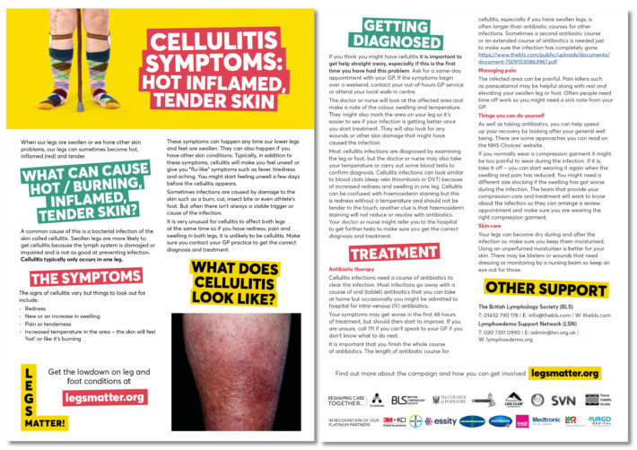 Cellulitis Symptoms Hot Burning Red Tender Skin On Your Lower Legs