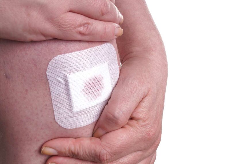 Basic wound dressing applied to the know. Learn more about what dressing to use on which wound.